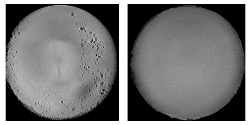 Badania tomografii rentgenowskiej_CT scan examination